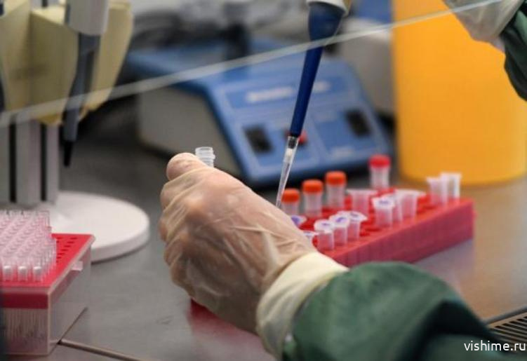 Учёные Роспотребнадзора создали высокоточный тест для диагностики коронавируса
