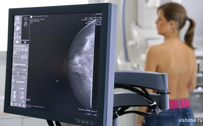 Цифровой маммограф для ишимских пациенток 